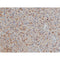 AF0198 at 1/50 staining human lymphoma tissue sections by IHC-P. The tissue was formaldehyde fixed and a heat mediated antigen retrieval step in citrate buffer was performed. The tissue was then blocked and incubated with the antibody for 1.5 hours at 22¡ãC. An HRP conjugated goat anti-rabbit antibody was used as the secondary