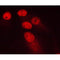 AF0198 staining MCF-7 cells by ICC/IF. Cells were fixed with PFA and permeabilized in 0.1% saponin prior to blocking in 10% serum for 45 minutes at 37¡ãC. The primary antibody was diluted 1/400 and incubated with the sample for 1 hour at 37¡ãC. A  Alexa Fluor? 594 conjugated goat polyclonal to rabbit IgG (H+L), diluted 1/600 was used as secondary antibod