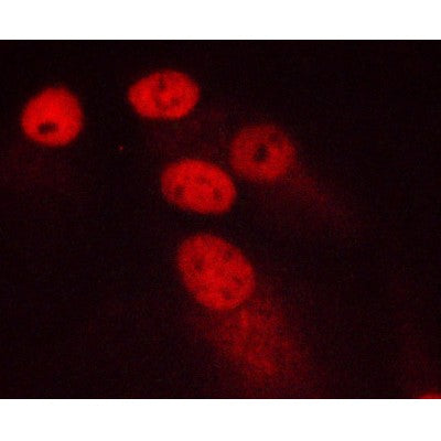 AF0198 staining MCF-7 cells by ICC/IF. Cells were fixed with PFA and permeabilized in 0.1% saponin prior to blocking in 10% serum for 45 minutes at 37¡ãC. The primary antibody was diluted 1/400 and incubated with the sample for 1 hour at 37¡ãC. A  Alexa Fluor? 594 conjugated goat polyclonal to rabbit IgG (H+L), diluted 1/600 was used as secondary antibod