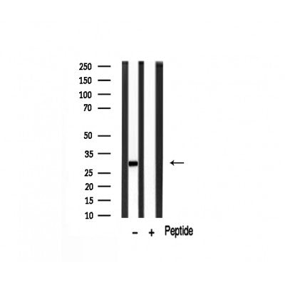 Western blot analysis of MMP7 expression in Mouse brain lysate