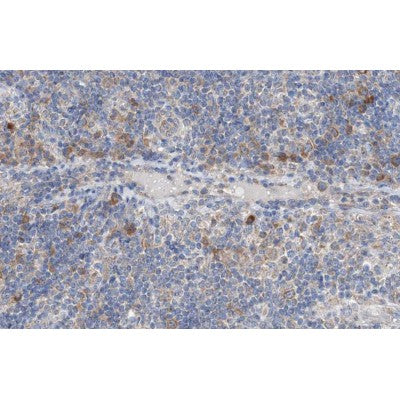 AF0679 at 1/100 staining human lymph node tissue sections by IHC-P. The tissue was formaldehyde fixed and a heat mediated antigen retrieval step in citrate buffer was performed. The tissue was then blocked and incubated with the antibody for 1.5 hours at 22¡ãC. An HRP conjugated goat anti-rabbit antibody was used as the secondary