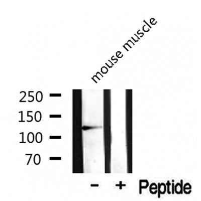 Western blot analysis on mouse muscle lysate using SKP2/p45 Antibody