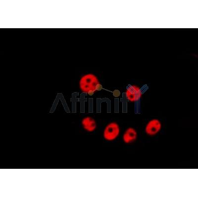 AF0505 staining Hela by IF/ICC. The sample were fixed with PFA and permeabilized in 0.1% Triton X-100,then blocked in 10% serum for 45 minutes at 25¡ãC. The primary antibody was diluted at 1/200 and incubated with the sample for 1 hour at 37¡ãC. An  Alexa Fluor 594 conjugated goat anti-rabbit IgG (H+L) Ab, diluted at 1/600, was used as the secondary antibod