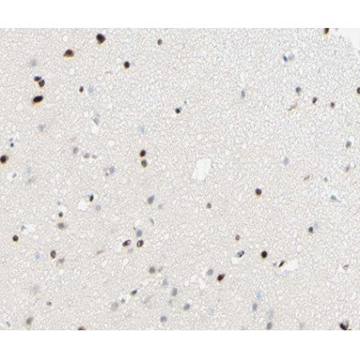 AF0487 at 1/100 staining human brain tissue sections by IHC-P. The tissue was formaldehyde fixed and a heat mediated antigen retrieval step in citrate buffer was performed. The tissue was then blocked and incubated with the antibody for 1.5 hours at 22¡ãC. An HRP conjugated goat anti-rabbit antibody was used as the secondary