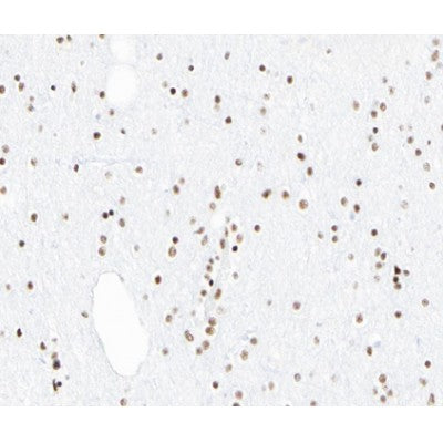 Western blot analysis of extracts from HepG2, using PIAS1 Antibody. Lane 1 was treated with the blocking peptide.