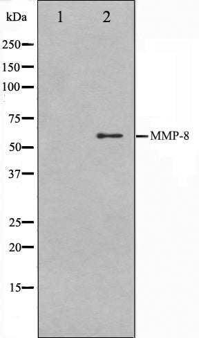 Western blot analysis on NIH-3T3 cell lysate using MMP8 Antibody. The lane on the left is treated with the antigen-specific peptide.