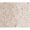 AF0289 at 1/100 staining human brain tissue sections by IHC-P. The tissue was formaldehyde fixed and a heat mediated antigen retrieval step in citrate buffer was performed. The tissue was then blocked and incubated with the antibody for 1.5 hours at 22¡ãC. An HRP conjugated goat anti-rabbit antibody was used as the secondary