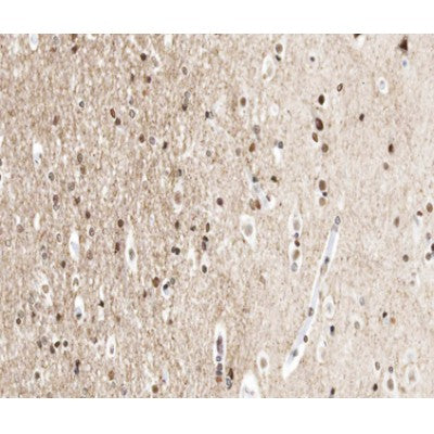 AF0289 at 1/100 staining human brain tissue sections by IHC-P. The tissue was formaldehyde fixed and a heat mediated antigen retrieval step in citrate buffer was performed. The tissue was then blocked and incubated with the antibody for 1.5 hours at 22¡ãC. An HRP conjugated goat anti-rabbit antibody was used as the secondary