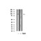 Western blot analysis of TM16J Antibody expression in Hela cells lysates.The lane on the right is treated with the antigen-specific peptide.