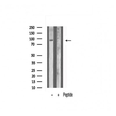Western blot analysis of TM16J Antibody expression in Hela cells lysates.The lane on the right is treated with the antigen-specific peptide.