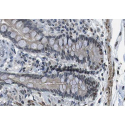 AF0301 at 1/100 staining human colon tissue sections by IHC-P. The tissue was formaldehyde fixed and a heat mediated antigen retrieval step in citrate buffer was performed. The tissue was then blocked and incubated with the antibody for 1.5 hours at 22¡ãC. An HRP conjugated goat anti-rabbit antibody was used as the secondary