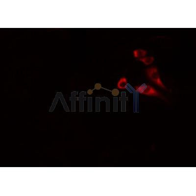 AF0301 staining MCF-7 cells by IF/ICC. The sample were fixed with PFA and permeabilized in 0.1% Triton X-100,then blocked in 10% serum for 45 minutes at 25¡ãC. The primary antibody was diluted at 1/200 and incubated with the sample for 1 hour at 37¡ãC. An  Alexa Fluor 594 conjugated goat anti-rabbit IgG (H+L) antibody(Cat.