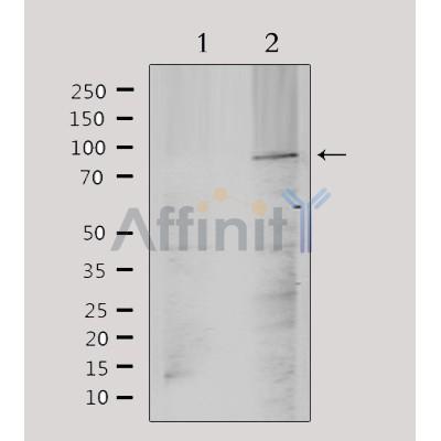 Western blot analysis of extracts from mouse brain, using TM16J Antibody. Lane 1 was treated with the antigen-specific peptide.