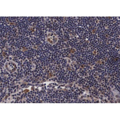 AF0318 at 1/100 staining human lymph node tissue sections by IHC-P. The tissue was formaldehyde fixed and a heat mediated antigen retrieval step in citrate buffer was performed. The tissue was then blocked and incubated with the antibody for 1.5 hours at 22¡ãC. An HRP conjugated goat anti-rabbit antibody was used as the secondary