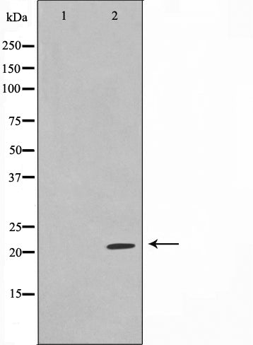 AF0703 staining Hela by IF/ICC. The sample were fixed with PFA and permeabilized in 0.1% Triton X-100,then blocked in 10% serum for 45 minutes at 25¡ãC. The primary antibody was diluted at 1/200 and incubated with the sample for 1 hour at 37¡ãC. An  Alexa Fluor 594 conjugated goat anti-rabbit IgG (H+L) Ab, diluted at 1/600, was used as the secondary antibod