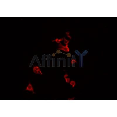 AF0329 staining HeLa  cells by IF/ICC. The sample were fixed with PFA and permeabilized in 0.1% Triton X-100,then blocked in 10% serum for 45 minutes at 25¡ãC. The primary antibody was diluted at 1/200 and incubated with the sample for 1 hour at 37¡ãC. An  Alexa Fluor 594 conjugated goat anti-rabbit IgG (H+L) antibody(Cat.# S0006), diluted at 1/600, was used as secondary antibod