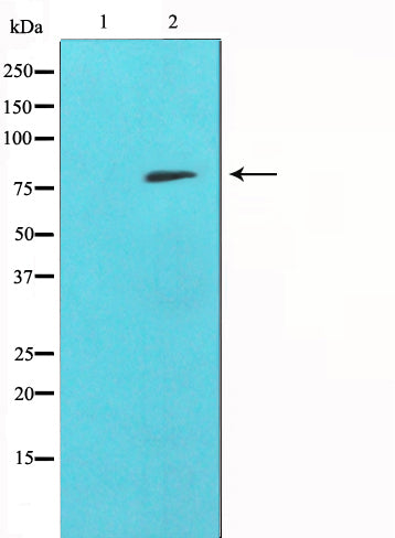 Western blot analysis on HepG2 cell lysate using MMP9 Antibody. The lane on the left is treated with the antigen-specific peptide.
