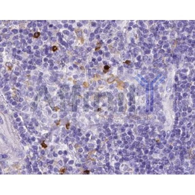 IHC analysis of Mouse liver tissue, using MMP9 Antibody at 1/100