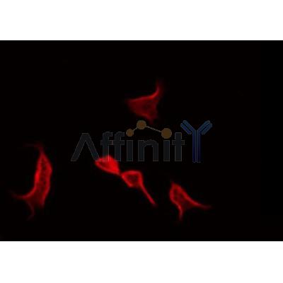 AF0220 staining HepG2 by IF/ICC. The sample were fixed with PFA and permeabilized in 0.1% Triton X-100,then blocked in 10% serum for 45 minutes at 25¡ãC. The primary antibody was diluted at 1/200 and incubated with the sample for 1 hour at 37¡ãC. An  Alexa Fluor 594 conjugated goat anti-rabbit IgG (H+L) Ab, diluted at 1/600, was used as the secondary antibod