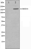 Western blot analysis of MED14 Antibody expression in Hela cells lysates.The lane on the left is treated with the antigen-specific peptide.