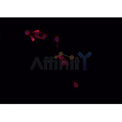 AF0336 staining Hep G2 cells by IF/ICC. The sample were fixed with PFA and permeabilized in 0.1% Triton X-100,then blocked in 10% serum for 45 minutes at 25¡ãC. The primary antibody was diluted at 1/200 and incubated with the sample for 1 hour at 37¡ãC. An  Alexa Fluor 594 conjugated goat anti-rabbit IgG (H+L) antibody(Cat.