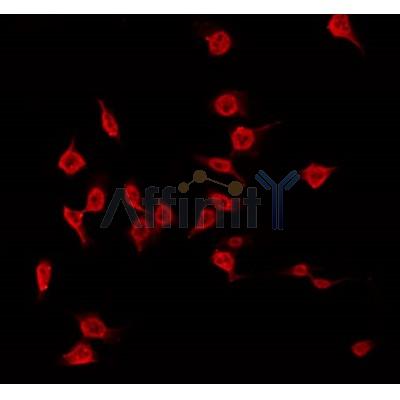 AF0497 staining Hela by IF/ICC. The sample were fixed with PFA and permeabilized in 0.1% Triton X-100,then blocked in 10% serum for 45 minutes at 25¡ãC. The primary antibody was diluted at 1/200 and incubated with the sample for 1 hour at 37¡ãC. An  Alexa Fluor 594 conjugated goat anti-rabbit IgG (H+L) Ab, diluted at 1/600, was used as the secondary antibod