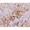 AF0342 at 1/100 staining human liver tissue sections by IHC-P. The tissue was formaldehyde fixed and a heat mediated antigen retrieval step in citrate buffer was performed. The tissue was then blocked and incubated with the antibody for 1.5 hours at 22¡ãC. An HRP conjugated goat anti-rabbit antibody was used as the secondary