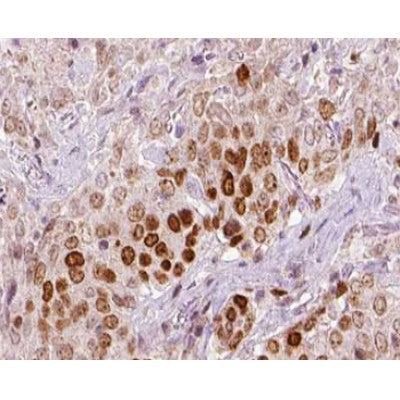 AF0342 at 1/100 staining human liver tissue sections by IHC-P. The tissue was formaldehyde fixed and a heat mediated antigen retrieval step in citrate buffer was performed. The tissue was then blocked and incubated with the antibody for 1.5 hours at 22¡ãC. An HRP conjugated goat anti-rabbit antibody was used as the secondary