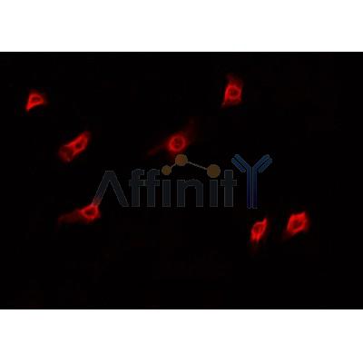 AF0507 staining A549 cells by IF/ICC. The sample were fixed with PFA and permeabilized in 0.1% Triton X-100,then blocked in 10% serum for 45 minutes at 25¡ãC. The primary antibody was diluted at 1/200 and incubated with the sample for 1 hour at 37¡ãC. An  Alexa Fluor 594 conjugated goat anti-rabbit IgG (H+L) antibody(Cat.
