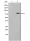 Western blot analysis on COLO205 cell lysate using TRIM3 Antibody,The lane on the left is treated with the antigen-specific peptide.