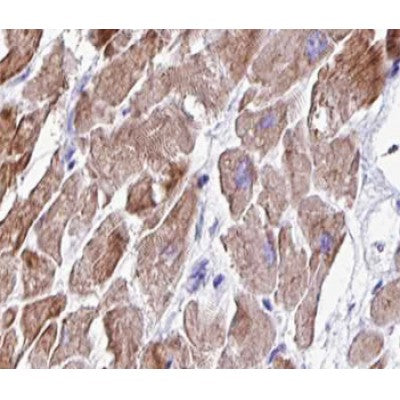AF0453 at 1/100 staining human heart muscle tissue sections by IHC-P. The tissue was formaldehyde fixed and a heat mediated antigen retrieval step in citrate buffer was performed. The tissue was then blocked and incubated with the antibody for 1.5 hours at 22¡ãC. An HRP conjugated goat anti-rabbit antibody was used as the secondary