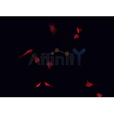 AF0456 staining K562  cells by IF/ICC. The sample were fixed with PFA and permeabilized in 0.1% Triton X-100,then blocked in 10% serum for 45 minutes at 25¡ãC. The primary antibody was diluted at 1/200 and incubated with the sample for 1 hour at 37¡ãC. An  Alexa Fluor 594 conjugated goat anti-rabbit IgG (H+L) antibody(Cat.# S0006), diluted at 1/600, was used as secondary antibod