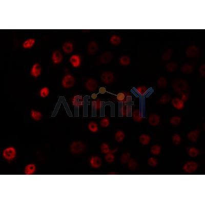 AF0504 staining HuvEc by IF/ICC. The sample were fixed with PFA and permeabilized in 0.1% Triton X-100,then blocked in 10% serum for 45 minutes at 25¡ãC. The primary antibody was diluted at 1/200 and incubated with the sample for 1 hour at 37¡ãC. An  Alexa Fluor 594 conjugated goat anti-rabbit IgG (H+L) Ab, diluted at 1/600, was used as the secondary antibod