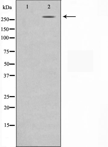 Western blot analysis on MDA-MB-435 cell lysate using NCoR1 Antibody,The lane on the left is treated with the antigen-specific peptide.