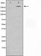 Western blot analysis on MDA-MB-435 cell lysate using NCoR1 Antibody,The lane on the left is treated with the antigen-specific peptide.