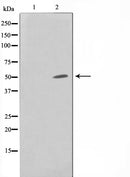 Western blot analysis on HuvEc cell lysate using SUPT3H Antibody,The lane on the left is treated with the antigen-specific peptide.