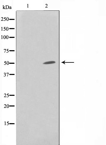 Western blot analysis on HuvEc cell lysate using SUPT3H Antibody,The lane on the left is treated with the antigen-specific peptide.
