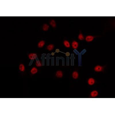 AF0498 staining HuvEc by IF/ICC. The sample were fixed with PFA and permeabilized in 0.1% Triton X-100,then blocked in 10% serum for 45 minutes at 25¡ãC. The primary antibody was diluted at 1/200 and incubated with the sample for 1 hour at 37¡ãC. An  Alexa Fluor 594 conjugated goat anti-rabbit IgG (H+L) Ab, diluted at 1/600, was used as the secondary antibod