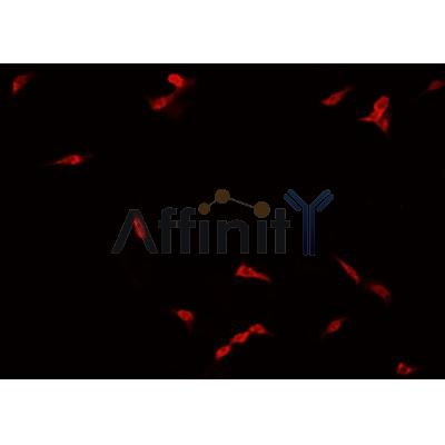 AF0426 staining NCI-H929  cells by IF/ICC. The sample were fixed with PFA and permeabilized in 0.1% Triton X-100,then blocked in 10% serum for 45 minutes at 25¡ãC. The primary antibody was diluted at 1/200 and incubated with the sample for 1 hour at 37¡ãC. An  Alexa Fluor 594 conjugated goat anti-rabbit IgG (H+L) antibody(Cat.# S0006), diluted at 1/600, was used as secondary antibod