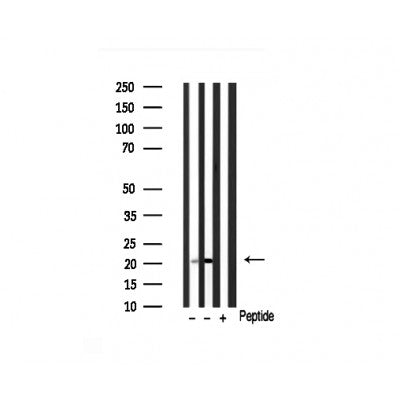 Western blot analysis of CIB2 Antibody expression in Various tissues lysates.The lane on the right is treated with the antigen-specific peptide.