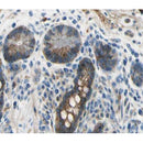 AF0424 at 1/100 staining human colon tissue sections by IHC-P. The tissue was formaldehyde fixed and a heat mediated antigen retrieval step in citrate buffer was performed. The tissue was then blocked and incubated with the antibody for 1.5 hours at 22¡ãC. An HRP conjugated goat anti-rabbit antibody was used as the secondary
