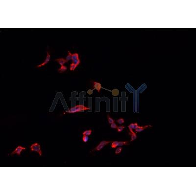 AF0424 staining HeLa  cells by IF/ICC. The sample were fixed with PFA and permeabilized in 0.1% Triton X-100,then blocked in 10% serum for 45 minutes at 25¡ãC. The primary antibody was diluted at 1/200 and incubated with the sample for 1 hour at 37¡ãC. An  Alexa Fluor 594 conjugated goat anti-rabbit IgG (H+L) antibody(Cat.