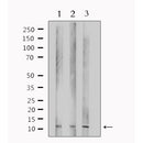Western blot analysis of extracts from various samples, using TUSC2 Antibody. lane 1: HepG2; lane 2: 293; lane 3: mouse lung; 