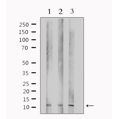 Western blot analysis of extracts from various samples, using TUSC2 Antibody. lane 1: HepG2; lane 2: 293; lane 3: mouse lung; 