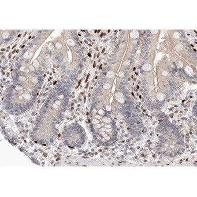AF0350 at 1/100 staining human colon tissue sections by IHC-P. The tissue was formaldehyde fixed and a heat mediated antigen retrieval step in citrate buffer was performed. The tissue was then blocked and incubated with the antibody for 1.5 hours at 22¡ãC. An HRP conjugated goat anti-rabbit antibody was used as the secondary