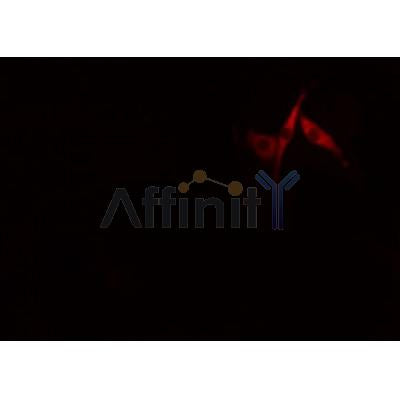 Western blot analysis of extracts from HepG2, using AKAP3 Antibody. Lane 1 was treated with the antigen-specific peptide.