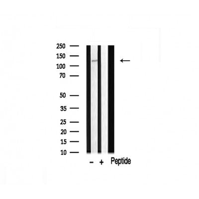 AF0527 staining HuvEc by IF/ICC. The sample were fixed with PFA and permeabilized in 0.1% Triton X-100,then blocked in 10% serum for 45 minutes at 25¡ãC. The primary antibody was diluted at 1/200 and incubated with the sample for 1 hour at 37¡ãC. An  Alexa Fluor 594 conjugated goat anti-rabbit IgG (H+L) Ab, diluted at 1/600, was used as the secondary antibod
