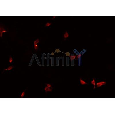 Western blot analysis of extracts from various samples, using HEXIM1 Antibody.
 Lane 1: Mouse  brain, treated with blocking peptide;
 Lane 2: Mouse  brain;
 Lane 3: COS-7.

Observed bands: 70 kDa.