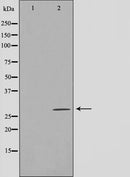 Western blot analysis on COLO205 cell lysate using LRAT Antibody