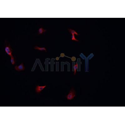 AF0486 staining A549 cells by IF/ICC. The sample were fixed with PFA and permeabilized in 0.1% Triton X-100,then blocked in 10% serum for 45 minutes at 25¡ãC. The primary antibody was diluted at 1/200 and incubated with the sample for 1 hour at 37¡ãC. An  Alexa Fluor 594 conjugated goat anti-rabbit IgG (H+L) antibody(Cat.